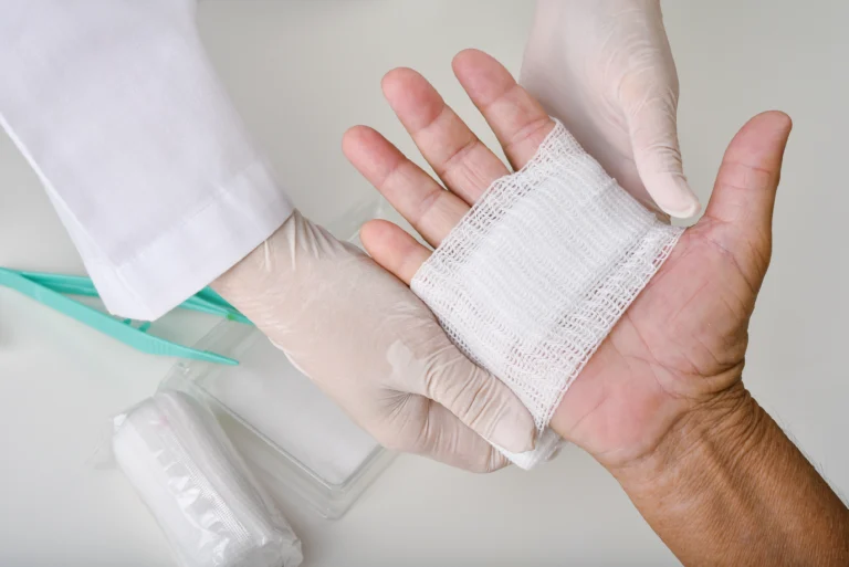 clinician treats a patient with a necrotic wound ont he hand