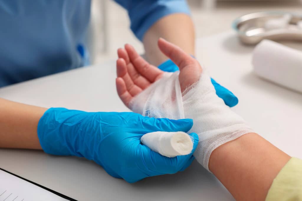 patient receives burn wound care