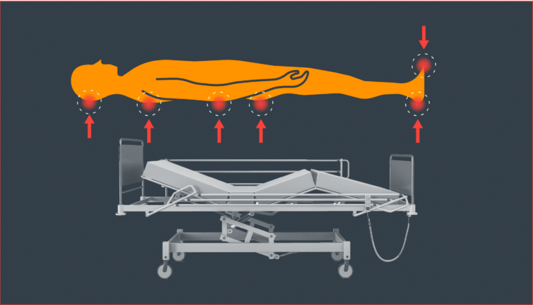 Pressure Injury Prevention: Hospitals’ Best Defense