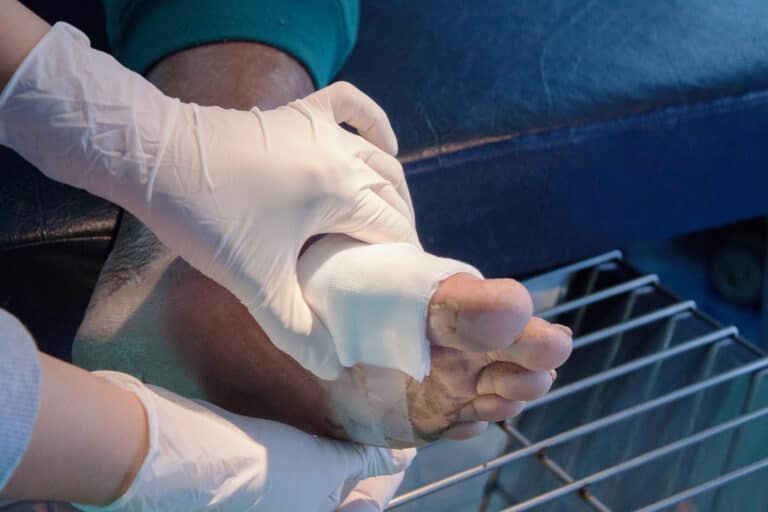 doctor performs diabetic wound care